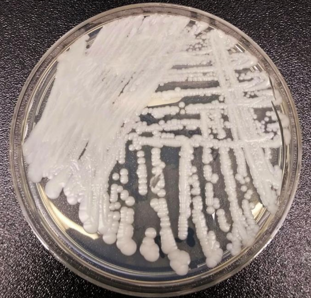 Candida auris